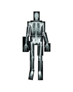 Human X-Rays Black/White Set